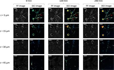 Dynamic full-field optical coherence tomography for live-cell imaging and growth-phase monitoring in Aspergillus fumigatus